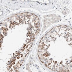 CASC3 Antibody, Novus Biologicals:Antibodies:Primary Antibodies